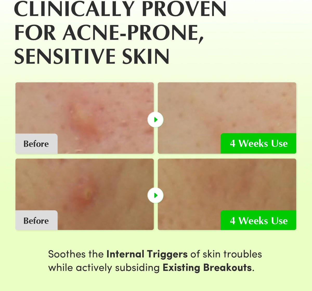 EQQUALBERRY Green Aid Aloe PDRN Calming Toner