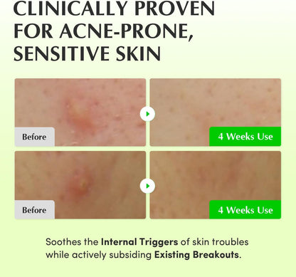 EQQUALBERRY Green Aid Aloe PDRN Calming Toner