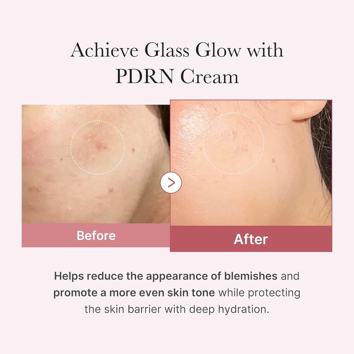 Medicube PDRN Pink Hyaluronic Moisturizing Cream