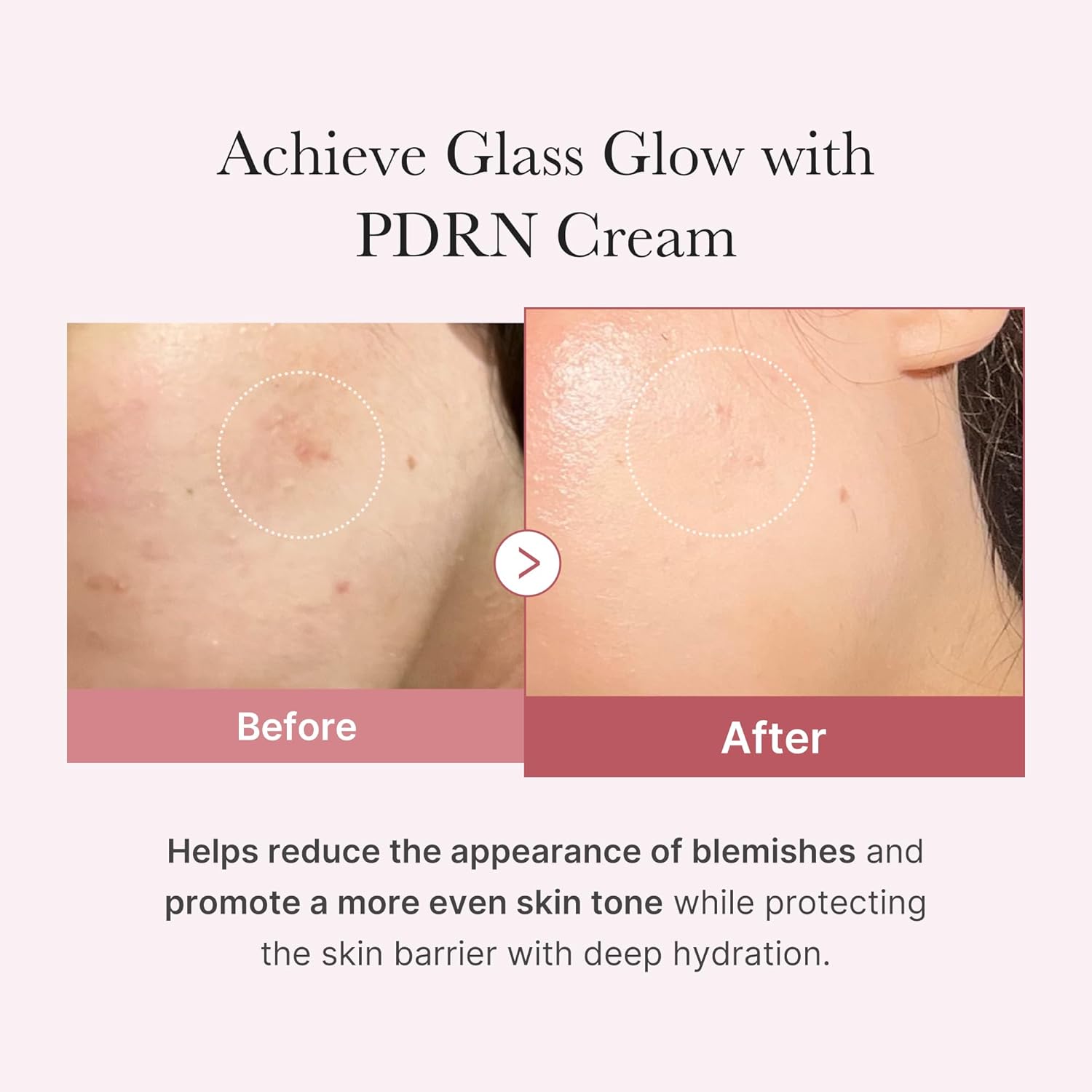Medicube PDRN Pink Hyaluronic Moisturizing Cream
