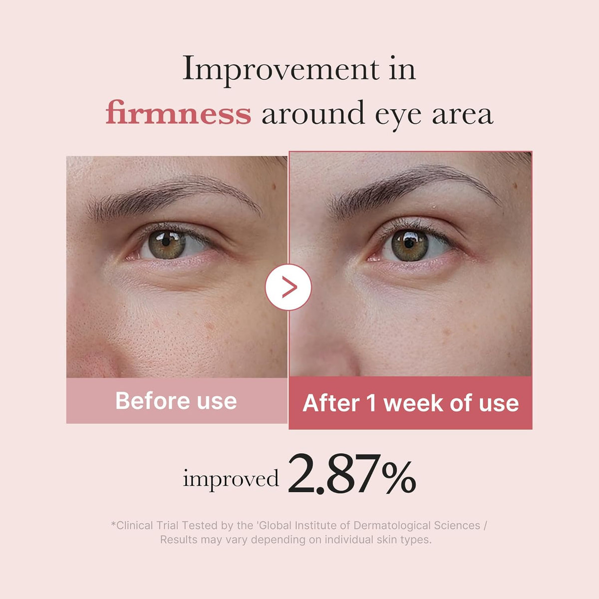 Medicube PDRN Pink Peptide Eye Cream 30ml