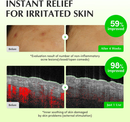 EQQUALBERRY Green Aid Aloe PDRN Calming Toner