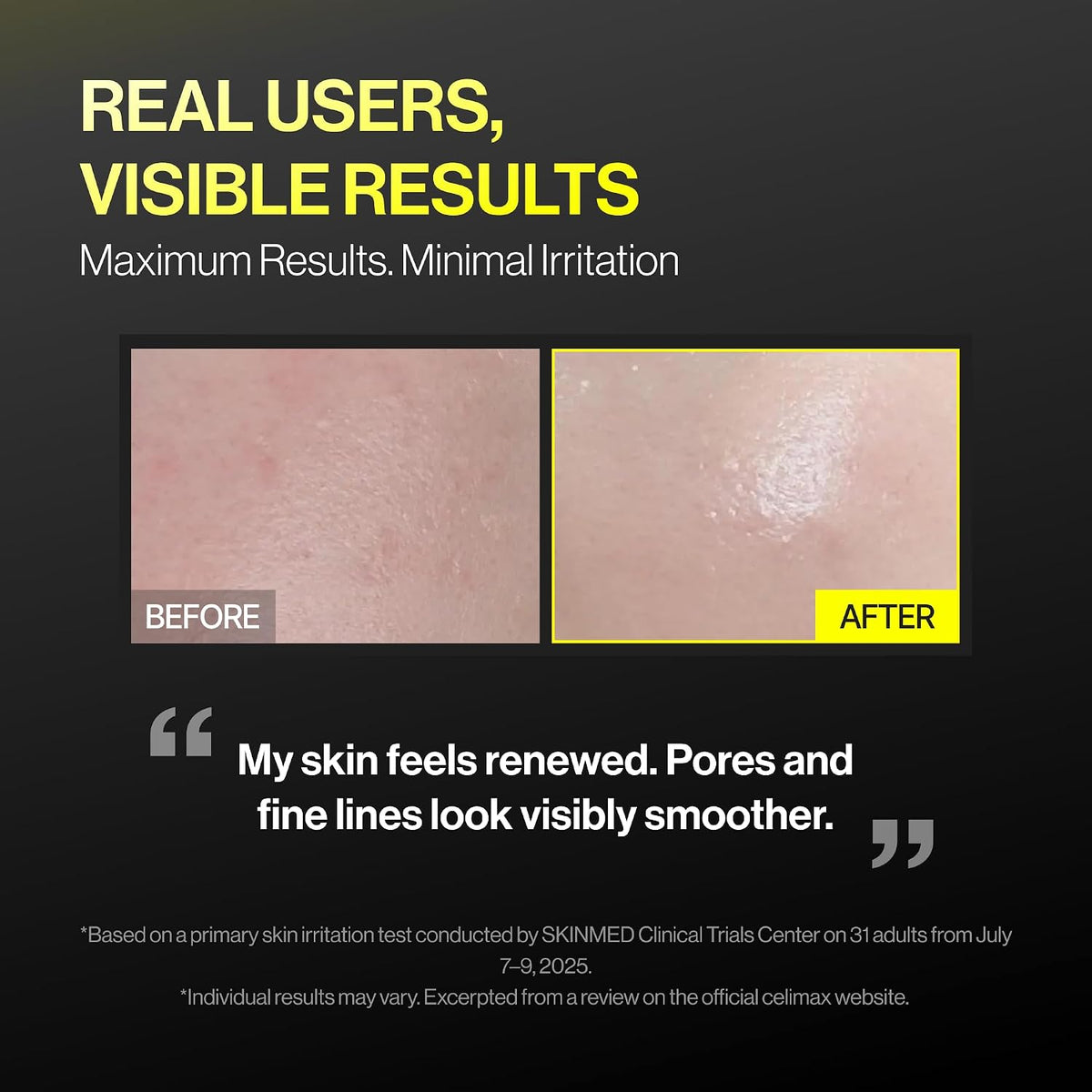 celimax The Vita-A Retinal Shot Tightening Booster
