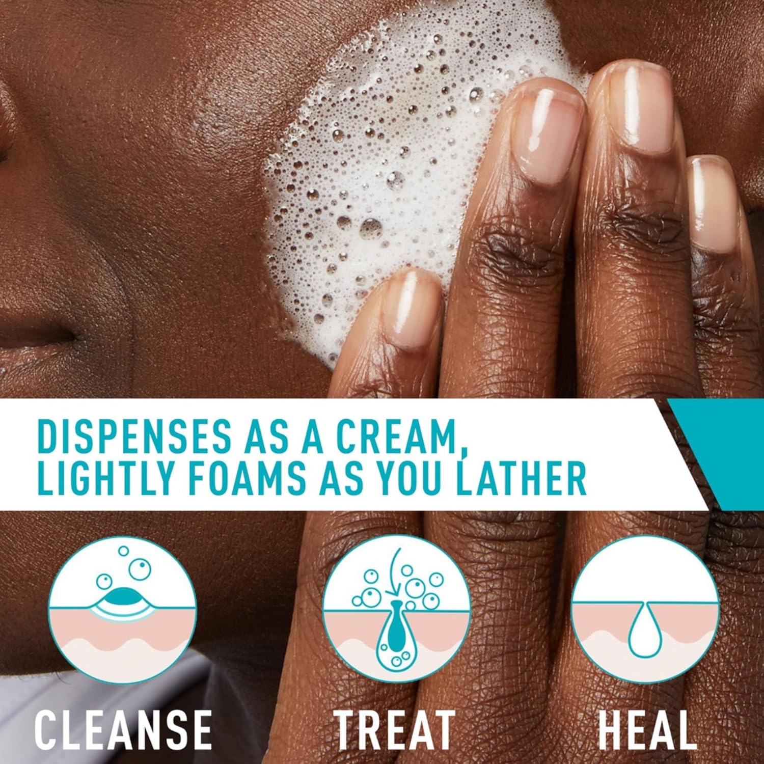 CeraVe Acne Foaming Cream Wash 150gm