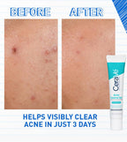 CeraVe Acne Control Gel - 40ml