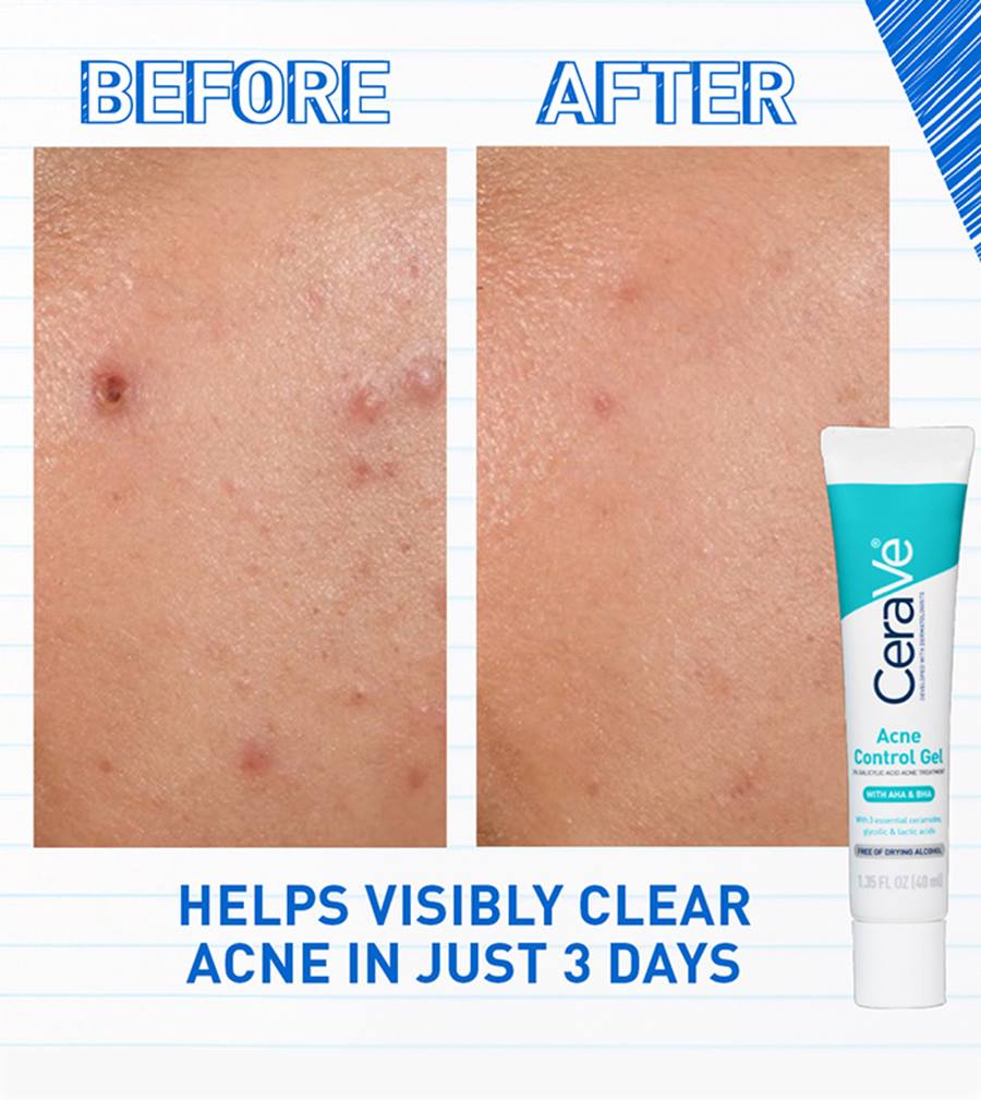 CeraVe Acne Control Gel - 40ml