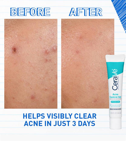 CeraVe Acne Control Gel - 40ml