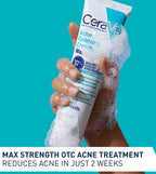 CeraVe Acne Foaming Cream Wash 150gm