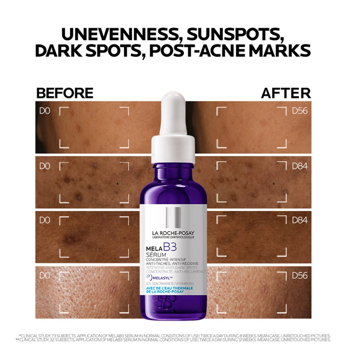La Roche-Posay Mela B3 Niacinamide Serum