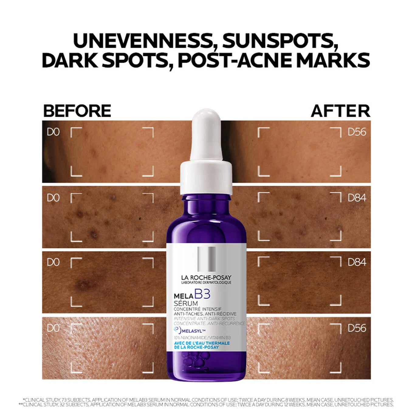 La Roche-Posay Mela B3 Niacinamide Serum