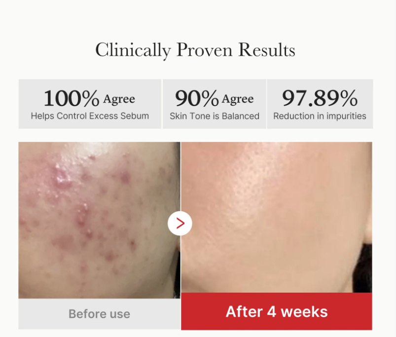 Medicube Red Succinic Acid Peeling 70 Pad