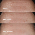 Clinique Smart Clinical Repair Wrinkle Correcting Serum